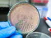 ecoli-1748921633737.jpg